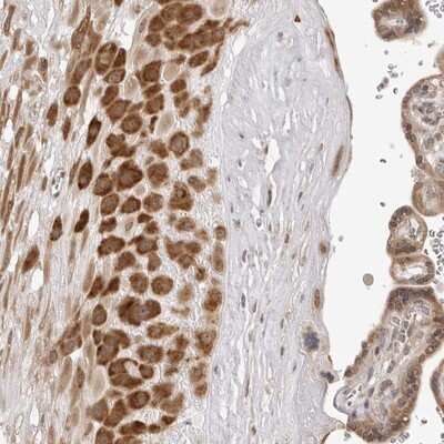 Immunohistochemistry-Paraffin: ZC3H11A Antibody [NBP1-82973] - Staining of human placenta shows strong cytoplasmic positivity in decidua cells.