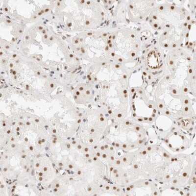 Immunohistochemistry-Paraffin: ZC3H11A Antibody [NBP1-82975] - Staining of human kidney shows moderate nuclear positivity in tubule cells.