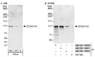 Western Blot: ZC3H11A Antibody [NB100-74650] - Detection of Human ZC3H11A on HeLa whole cell lysate using NB100-74650. ZC3H11A was also immunoprecipitated by rabbit anti-ZC3H11A antibodies NB100-74651 and NB100-74652.