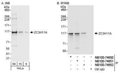 Western Blot: ZC3H11A Antibody [NB100-74651] - Detection of Human ZC3H11A on HeLa whole cell lysate using NB100-74651. ZC3H11A was also immunoprecipitated by rabbit anti-ZC3H11A antibodies NB100-74650 and NB100-74652.