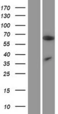 Western Blot: ZC3H12A Overexpression Lysate (Adult Normal) [NBP2-06242] Left-Empty vector transfected control cell lysate (HEK293 cell lysate); Right -Over-expression Lysate for ZC3H12A.