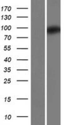 Western Blot: ZC3H12B Overexpression Lysate (Adult Normal) [NBP2-08768] Left-Empty vector transfected control cell lysate (HEK293 cell lysate); Right -Over-expression Lysate for ZC3H12B.