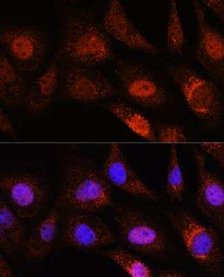 Immunocytochemistry/ Immunofluorescence ZC3H12D Antibody - Azide and BSA Free