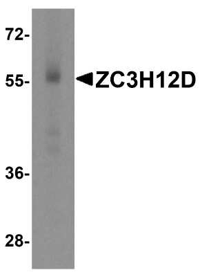 Western Blot: ZC3H12D Antibody [NBP2-81878] - Western blot analysis of ZC3H12D in human spleen tissue lysate with ZC3H12D antibody at 1 ug/mL.