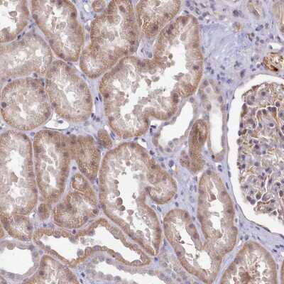 Immunohistochemistry: ZC3H13 Antibody [NBP2-48705] - Staining of human kidney shows moderate cytoplasmic positivity in cells in tubules.