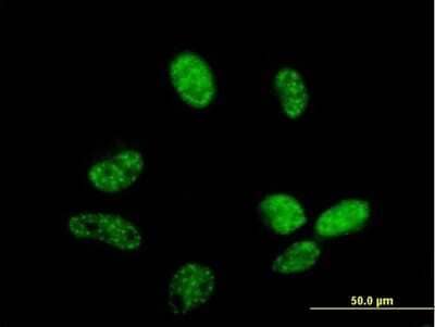 Immunocytochemistry/Immunofluorescence: ZC3H14 Antibody [H00079882-B01P] - Analysis of purified antibody to ZC3H14 on HeLa cell. (antibody concentration 10 ug/ml)