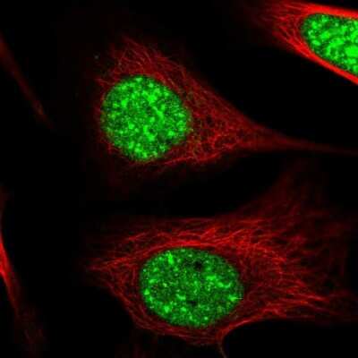 Immunocytochemistry/Immunofluorescence: ZC3H14 Antibody [NBP2-49087] - Immunofluorescent staining of human cell line U-2 OS shows localization to nucleoli & nuclear speckles.