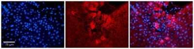 Immunohistochemistry: ZC3H14 Antibody [NBP1-56914] - Formalin Fixed Paraffin Embedded Tissue: Human Liver Tissue Observed Staining: Cytoplasm in hepatocytes Primary Antibody Concentration: 1:100 Other Working Concentrations: N/A Secondary Antibody: Donkey anti-Rabbit-Cy3 Secondary Antibody Concentration: 1:200 Magnification: 20X Exposure Time: 0.5 - 2.0 sec