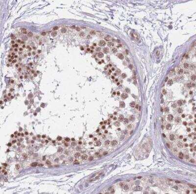 Immunohistochemistry-Paraffin: ZC3H14 Antibody [NBP2-13537] - Staining of human testis shows strong nuclear positivity in cells in seminiferous ducts.