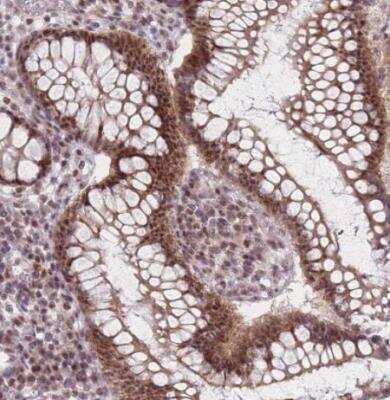 Immunohistochemistry-Paraffin: ZC3H14 Antibody [NBP2-13537] - Staining of human colon shows strong nuclear positivity in glandular cells.