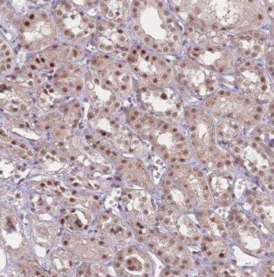 Immunohistochemistry-Paraffin: ZC3H14 Antibody [NBP2-13537] - Staining of human kidney shows moderate nuclear positivity in cells in tubules.