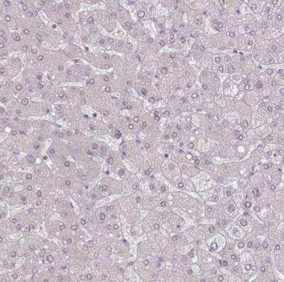 Immunohistochemistry-Paraffin: ZC3H14 Antibody [NBP2-13537] - Staining of human liver shows no nuclear positivity in hepatocytes as expected.