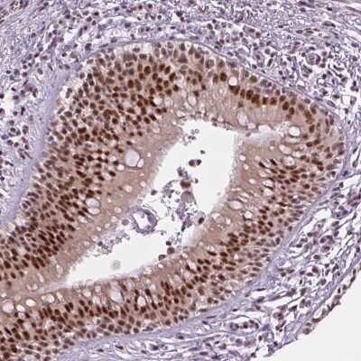 Immunohistochemistry-Paraffin: ZC3H14 Antibody [NBP2-49087] - Staining of human bronchus shows strong nuclear positivity in respiratory epithelial cells.