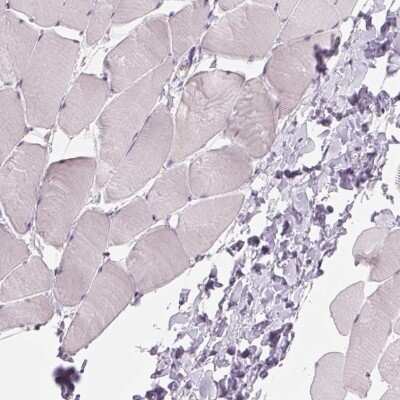 Immunohistochemistry-Paraffin: ZC3H14 Antibody [NBP2-49087] - Staining of human skeletal muscle shows low expression as expected.