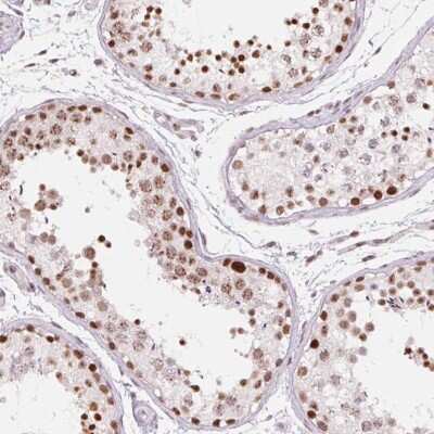 Immunohistochemistry-Paraffin: ZC3H14 Antibody [NBP2-49087] - Staining of human testis shows high expression.