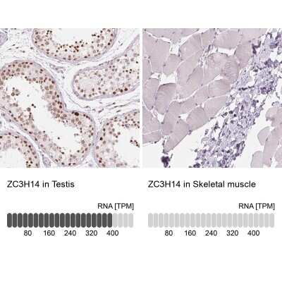 <b>Orthogonal Strategies Validation. </b>Immunohistochemistry-Paraffin: ZC3H14 Antibody [NBP2-49087] - Staining in human testis and skeletal muscle tissues using anti-ZC3H14 antibody. Corresponding ZC3H14 RNA-seq data are presented for the same tissues.