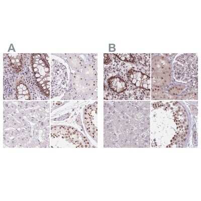 <b>Independent Antibodies Validation. </b>Immunohistochemistry-Paraffin: ZC3H14 Antibody [NBP2-49087] - Staining of human colon, kidney, liver and testis using Anti-ZC3H14 antibody NBP2-49087 (A) shows similar protein distribution across tissues to independent antibody NBP2-13537 (B).