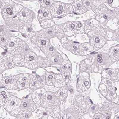 Immunohistochemistry-Paraffin: ZC3H14 Antibody [NBP2-49087] - Staining of human liver.