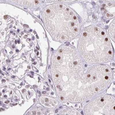 Immunohistochemistry-Paraffin: ZC3H14 Antibody [NBP2-49087] - Staining of human kidney.