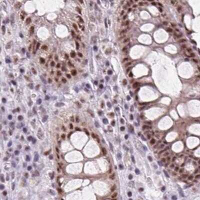 Immunohistochemistry-Paraffin: ZC3H14 Antibody [NBP2-49087] - Staining of human colon.