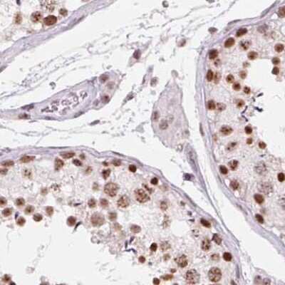 Immunohistochemistry-Paraffin: ZC3H14 Antibody [NBP2-49087] - Staining of human testis using Anti-ZC3H14 antibody NBP2-49087.