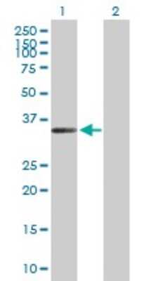 Western Blot: ZC3H14 Antibody [H00079882-B01P] - Analysis of FLJ11806 expression in transfected 293T cell line by FLJ11806 polyclonal antibody.  Lane 1: FLJ11806 transfected lysate(33.66 KDa). Lane 2: Non-transfected lysate.