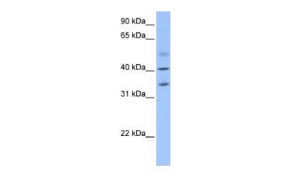 Western Blot: ZC3H14 Antibody [NBP1-56914] - Reccomended Titration: 0.2 - 1 ug/ml Positive Control: Human heart