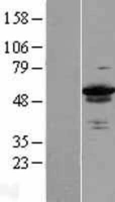 Western Blot ZC3H15 Overexpression Lysate