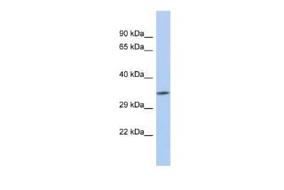 Western Blot: ZC3H3 Antibody [NBP2-88610] - Host: Rabbit. Target Name: ZC3H3. Sample Type: MCF7 Whole cell lysates. Antibody Dilution: 1.0ug/ml