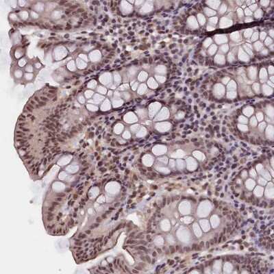 Immunohistochemistry-Paraffin: ZC3H4 Antibody [NBP1-88474] - Staining of human colon shows moderate nuclear positivity in glandular cells.