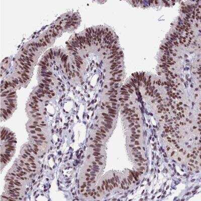 Immunohistochemistry-Paraffin: ZC3H4 Antibody [NBP1-88475] - Staining of human fallopian tube shows moderate nuclear positivity in glandular cells.