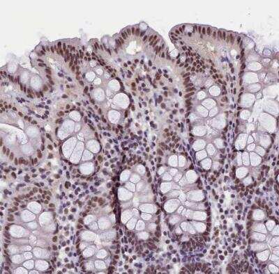 Immunohistochemistry-Paraffin: ZC3H4 Antibody [NBP1-88475] - Staining of human colon shows moderate to strong nuclear positivity in glandular cells.