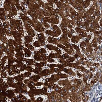 Immunohistochemistry-Paraffin: ZC3H7A Antibody [NBP1-82187] - Staining of human liver shows strong cytoplasmic positivity in hepatocytes.