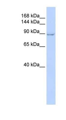 Western Blot: ZC3H7A Antibody [NBP1-79987] - Titration: 0.2-1 ug/ml, Positive Control: Hela cell lysate.