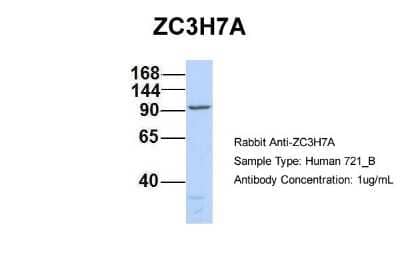 Western Blot: ZC3H7A Antibody [NBP1-79987] - Analysis of 721_B cell lysate. Antibody Dilution: 1.0 ug/ml ZC3H7A is supported by BioGPS gene expression data to be expressed in 721_B.
