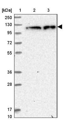 Western Blot: ZC3H7A Antibody [NBP1-82187] - Lane 1: Marker  [kDa] 250, 130, 95, 72, 55, 36, 28, 17, 10.  Lane 2: Human cell line RT-4.  Lane 3: Human cell line U-251MG sp