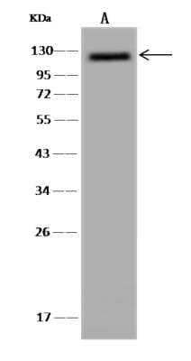 Western Blot: ZC3H7A Antibody [NBP3-06301] - Anti-ZC3H7A rabbit polyclonal antibody at 1:500 dilutionLane A: Hela Whole Cell LysateLysates/proteins at 30 ug per lane.SecondaryGoat Anti-Rabbit IgG (H+L) HRP at 110000 dilution.Developed using the ECL technique.Performed under reducing conditions.Predicted band size:110 kDa