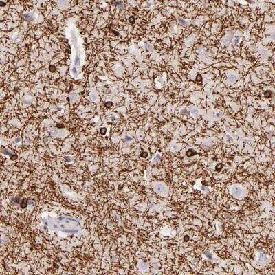 Immunohistochemistry-Paraffin: ZC3H7B Antibody [NBP1-85115] - Staining of human cerebral cortex shows strong cytoplasmic positivity in glial cells.
