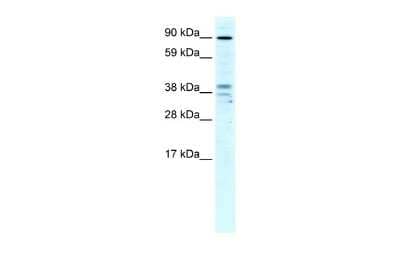 Western Blot: ZC3H7B Antibody [NBP2-83793] - WB Suggested Anti-ZC3H7B Antibody Titration: 4ug/ml. Positive Control: Human Liver