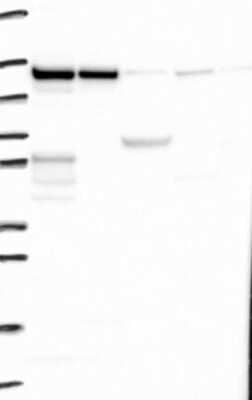 Western Blot: ZC3H7B Antibody [NBP3-17458] - Lane 1: Marker [kDa] 250, 130, 95, 72, 55, 36, 28, 17, 10;   Lane 2: RT4;   Lane 3: U-251 MG;   Lane 4: Human Plasma;   Lane 5: Liver;   Lane 6: Tonsil