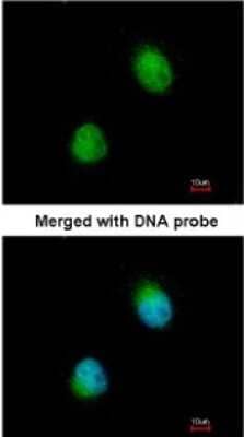 Immunocytochemistry/Immunofluorescence: ZC3H8 Antibody [NBP1-32522] - Paraformaldehyde-fixed HeLa, using antibody at 1:200 dilution.
