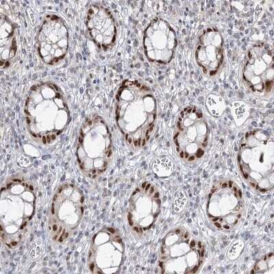 Immunohistochemistry-Paraffin: ZC3H8 Antibody [NBP1-84661] - Staining of human rectum shows strong nuclear positivity in glandular cells.