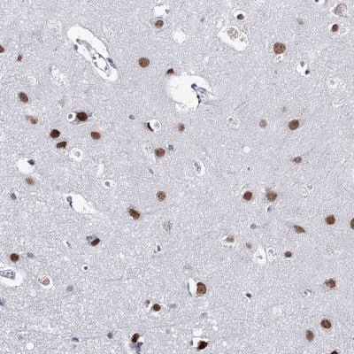 Immunohistochemistry-Paraffin: ZC3H8 Antibody [NBP2-33980] - Staining of human cerebral cortex shows strong nuclear positivity in neuronal cells.
