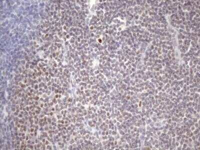 Immunohistochemistry: ZC3H8 Antibody (OTI4H5) - Azide and BSA Free [NBP2-74908] - Analysis of Human lymphoma tissue. (Heat-induced epitope retrieval by 1mM EDTA in 10mM Tris buffer (pH8.5) at 120C for 3 min)