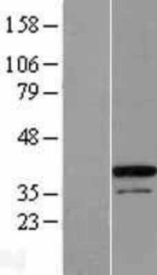 Western Blot: ZC3H8 Overexpression Lysate (Adult Normal) [NBL1-17985] Left-Empty vector transfected control cell lysate (HEK293 cell lysate); Right -Over-expression Lysate for ZC3H8.