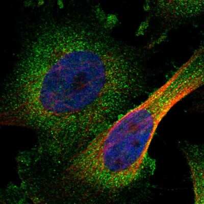 Immunocytochemistry/Immunofluorescence: ZC3HAV1L Antibody [NBP1-86726] - Immunofluorescent staining of human cell line U-251 MG shows localization to cytosol.