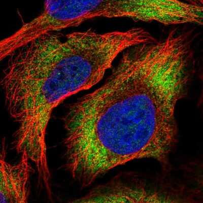 Immunocytochemistry/Immunofluorescence: ZC3HAV1L Antibody [NBP2-58199] - Staining of human cell line U-2 OS shows localization to cytosol.