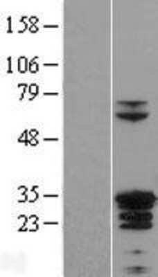 Western Blot: ZC4H2 Overexpression Lysate (Adult Normal) [NBP2-06786] Left-Empty vector transfected control cell lysate (HEK293 cell lysate); Right -Over-expression Lysate for ZC4H2.