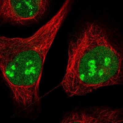 Immunocytochemistry/Immunofluorescence: ZCCHC10 Antibody [NBP1-82206] - Staining of human cell line U-2 OS shows localization to nucleus & nucleoli. Antibody staining is shown in green.