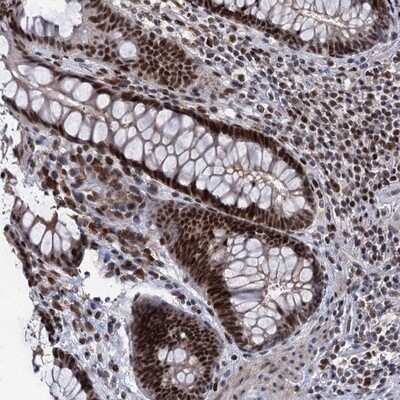 Immunohistochemistry-Paraffin: ZCCHC10 Antibody [NBP1-82206] - Staining of human rectum shows strong nuclear positivity in glandular cells.